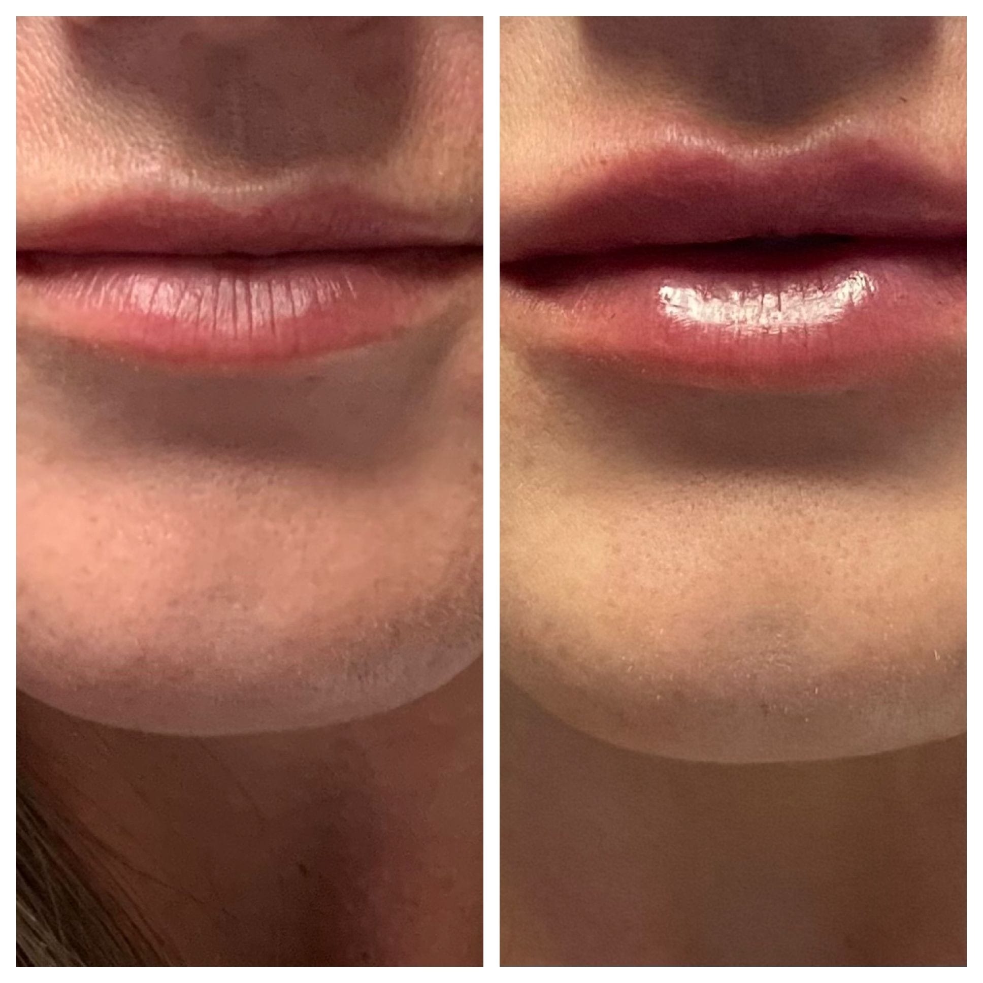 GLO Skin CareMD Lips-16
