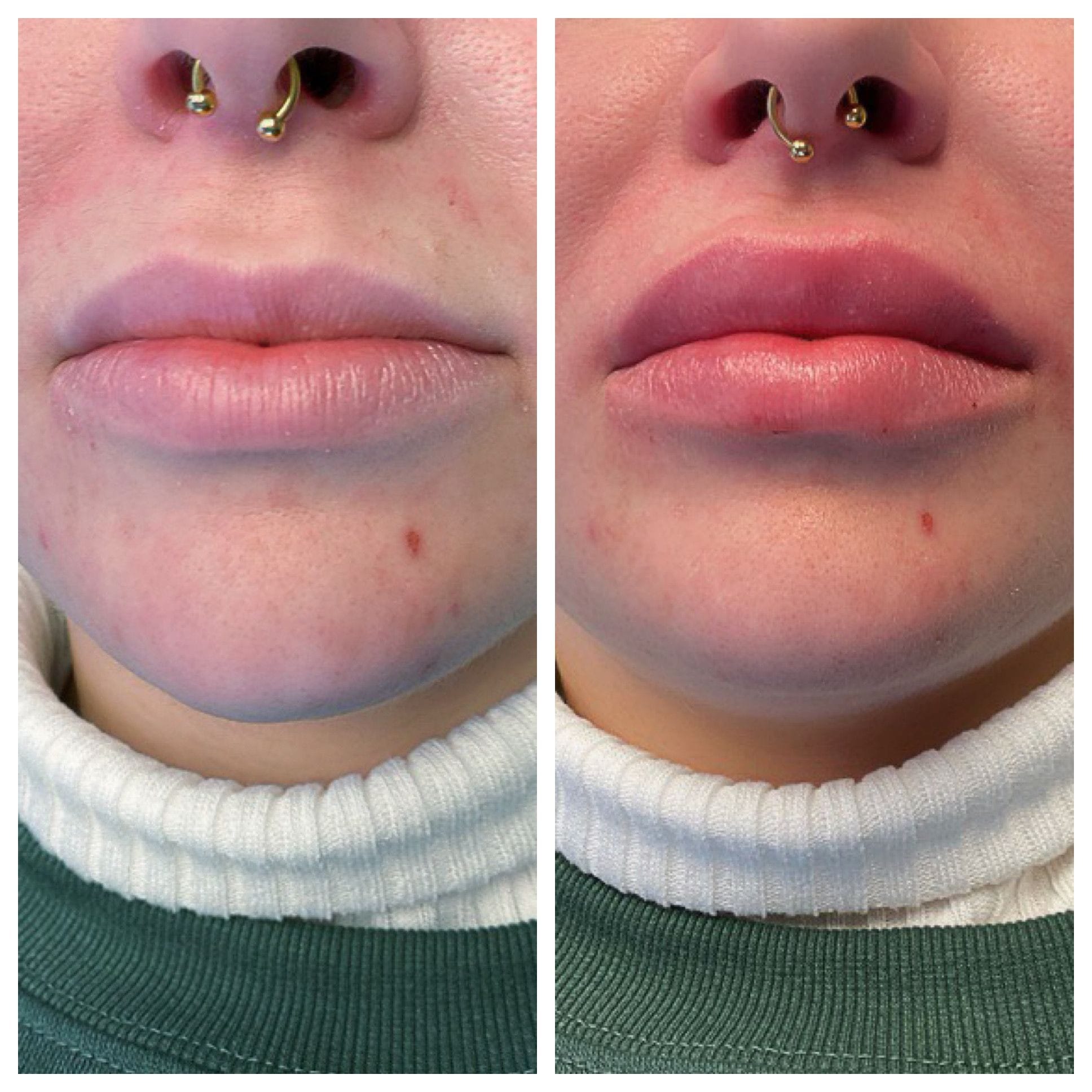 GLO Skin CareMD Lips-13