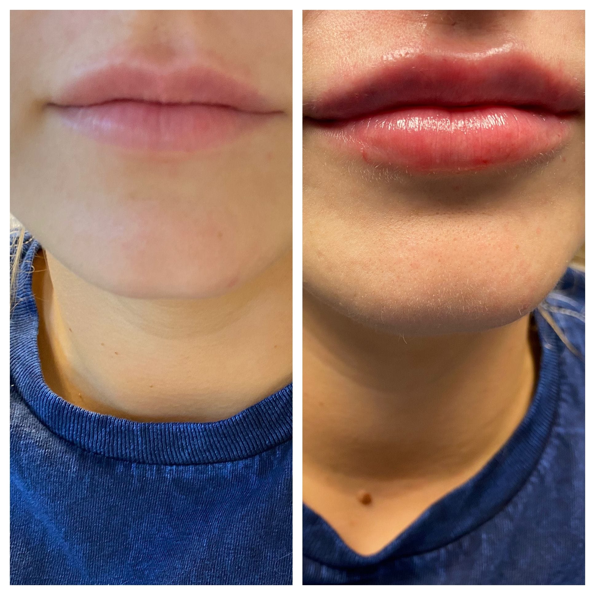 GLO Skin CareMD Lips-1