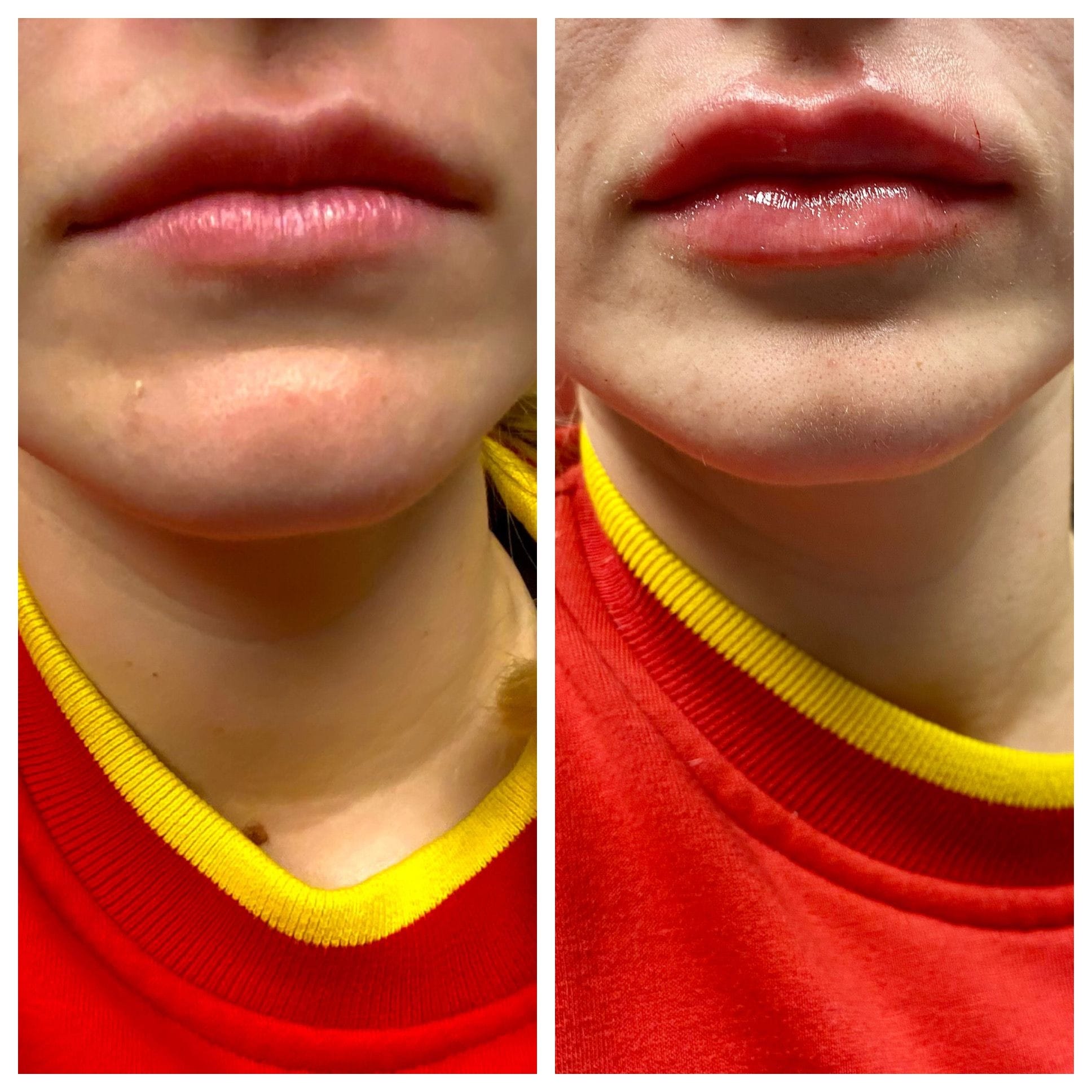 GLO Skin CareMD Lips-11