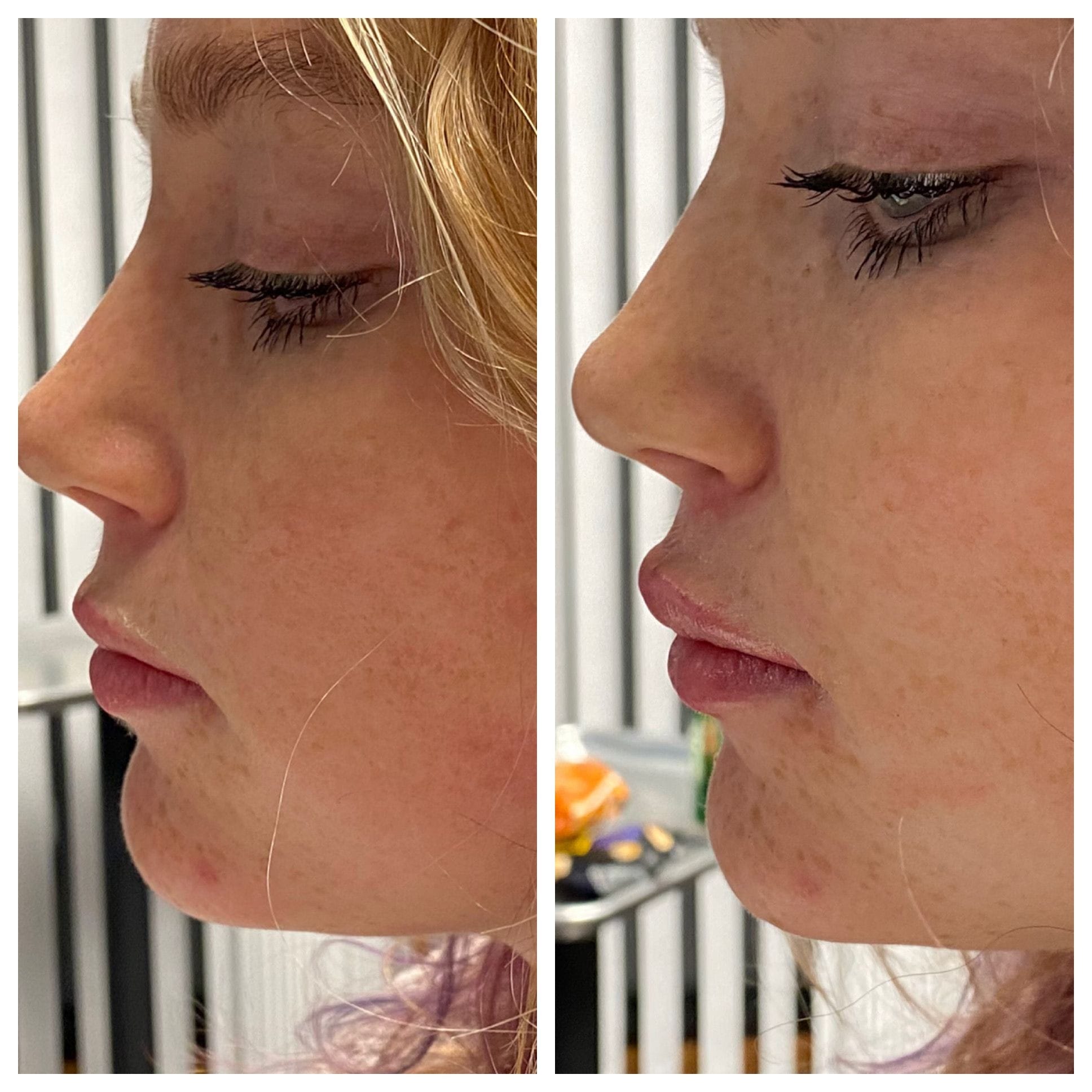 GLO Skin CareMD Lips-8