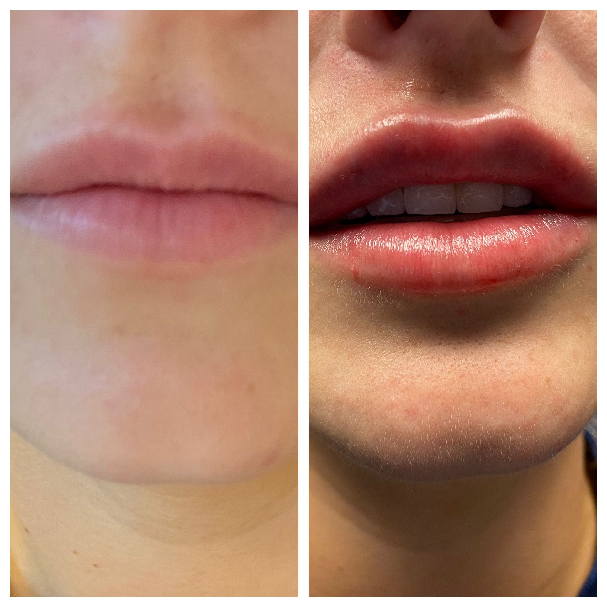 GLO Skin CareMD Lips-4