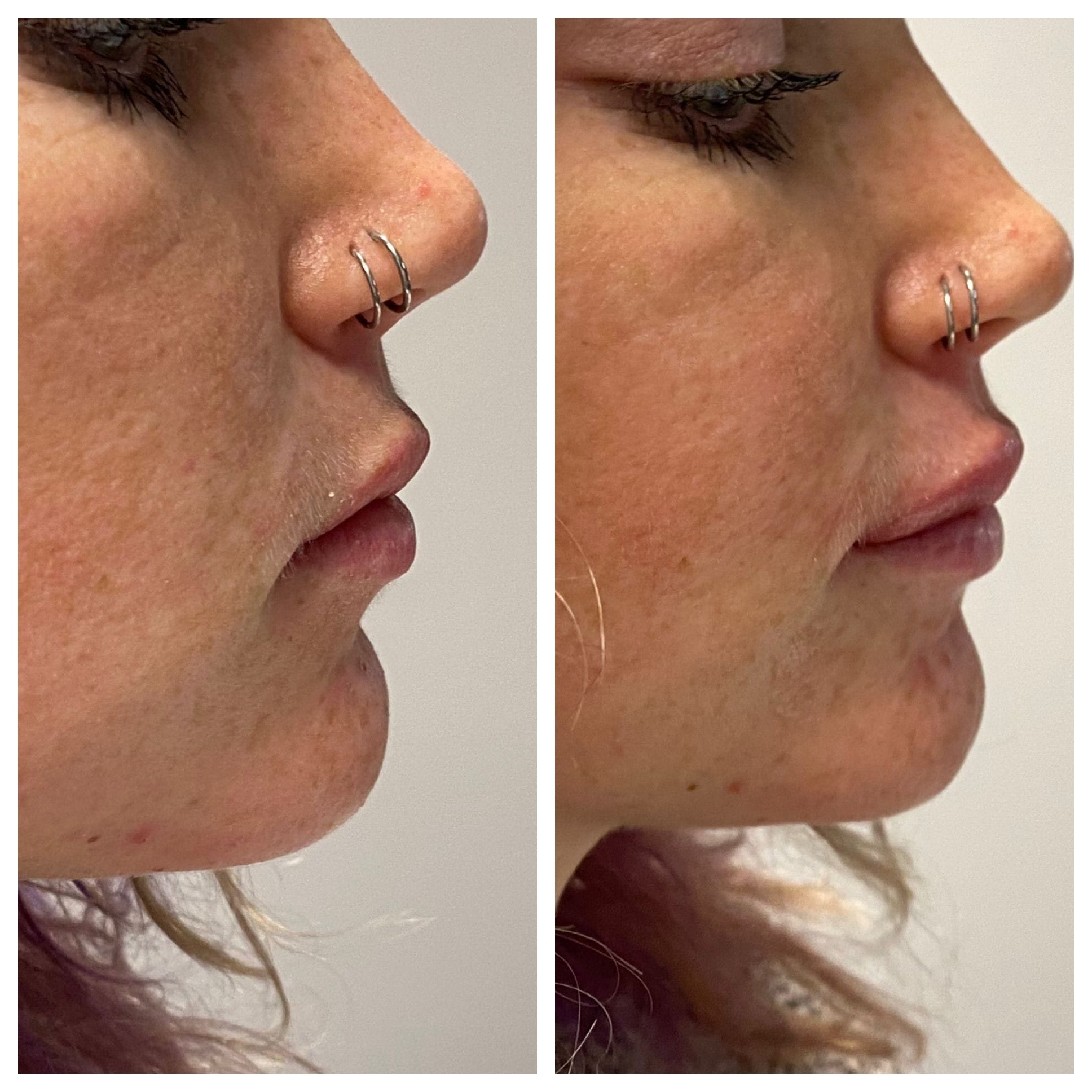 GLO Skin CareMD Lips-7